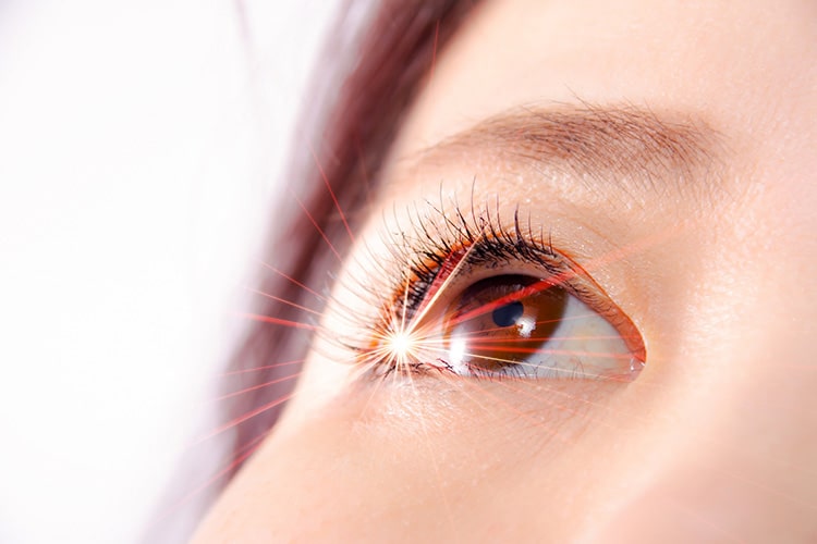 眼科レーザー治療画像